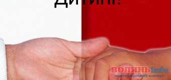 Маленька дівчинка з Луцька потребує допомоги