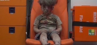 Поранений хлопчик став символом війни в Сирії