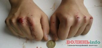“Монетка”: нова небезпечна підліткова гра