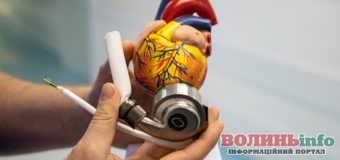 У київській лікарні вперше імплантували механічне серце