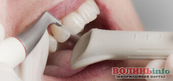 Профессиональная чистка зубов с помощью Air Flow: особенности и преимущества метода