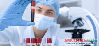 Чи можна робити аналіз крові після щеплення?
