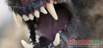 На Волині сусідський пес напав на 7-річну дівчинку: дитина з численними травмами у лікарні (ВІДЕО 18+)