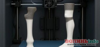 Майбутнє ортопедії: чому 3D друк змінює підхід до лікування пацієнтів