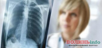 У Торчині біля лікарні працює пересувний флюорограф: обстеження безкоштовне