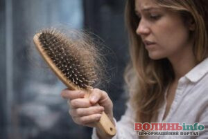 Які аналізи варто здати при інтенсивному випадінні волосся: пояснення лікарів